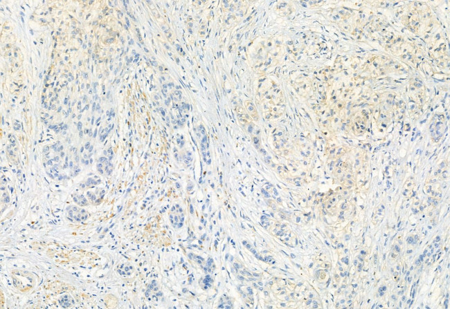 FKBP10 Antibody in Immunohistochemistry (Paraffin) (IHC (P))