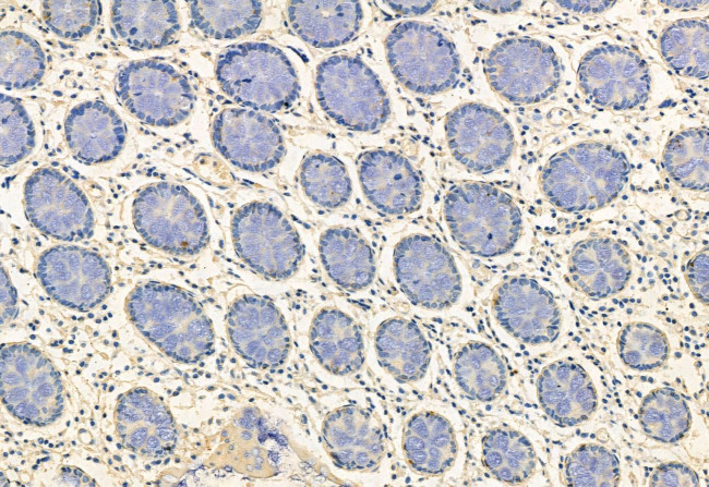 FKBP10 Antibody in Immunohistochemistry (Paraffin) (IHC (P))