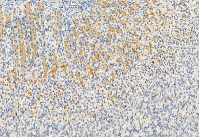 FKBP10 Antibody in Immunohistochemistry (Paraffin) (IHC (P))