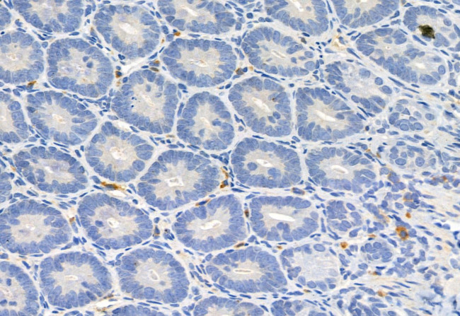 FKBP10 Antibody in Immunohistochemistry (Paraffin) (IHC (P))