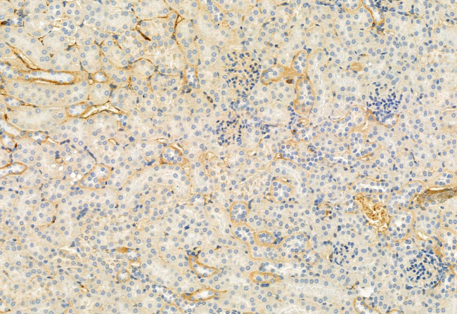 FKBP10 Antibody in Immunohistochemistry (Paraffin) (IHC (P))