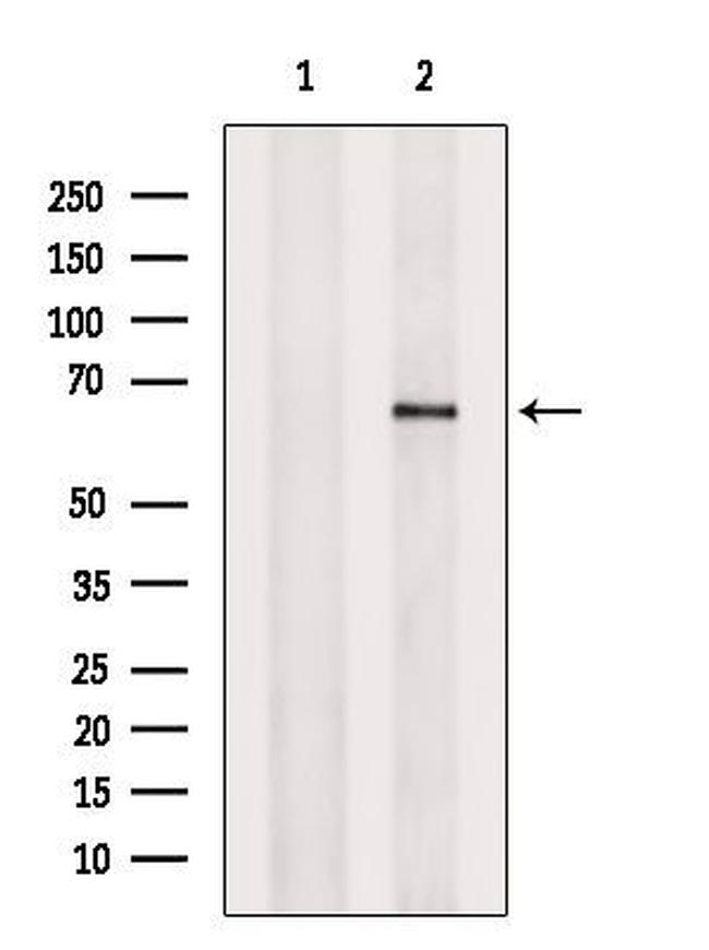 FKBP10 Antibody in Western Blot (WB)