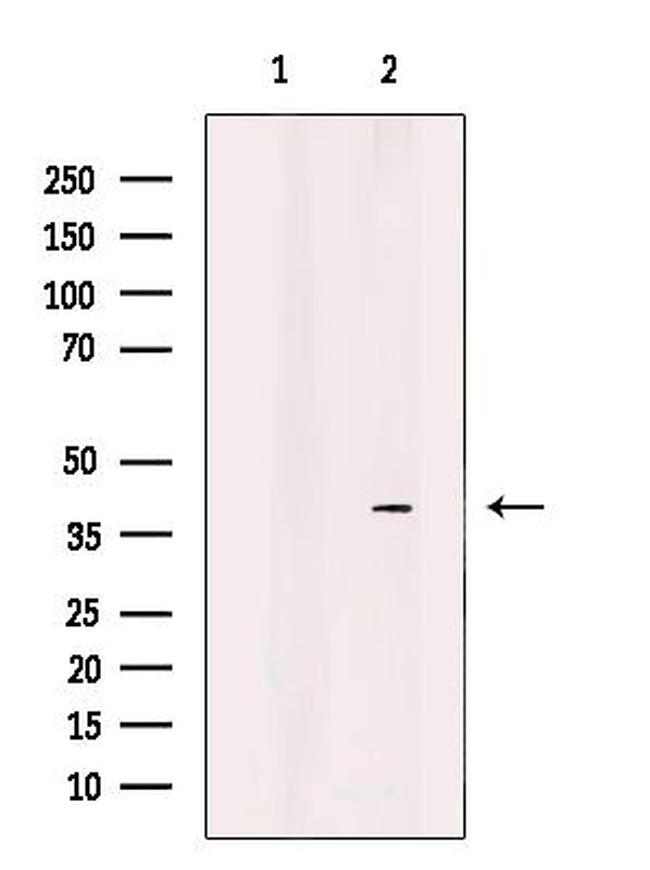 IST1 Antibody in Western Blot (WB)