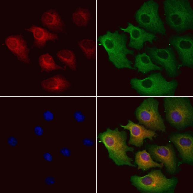 MCD Antibody in Immunocytochemistry (ICC/IF)