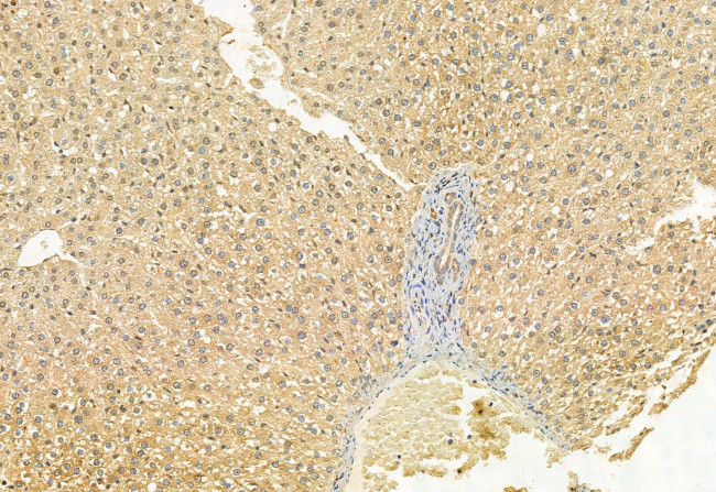 MCD Antibody in Immunohistochemistry (Paraffin) (IHC (P))