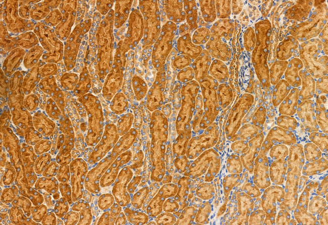 MCD Antibody in Immunohistochemistry (Paraffin) (IHC (P))