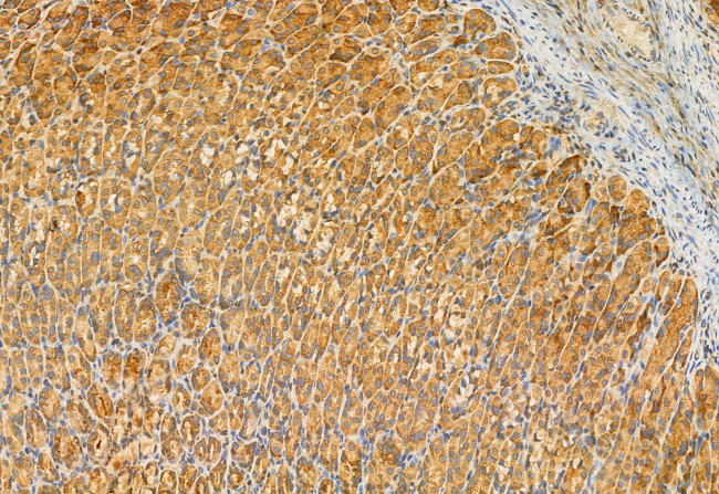 MCD Antibody in Immunohistochemistry (Paraffin) (IHC (P))