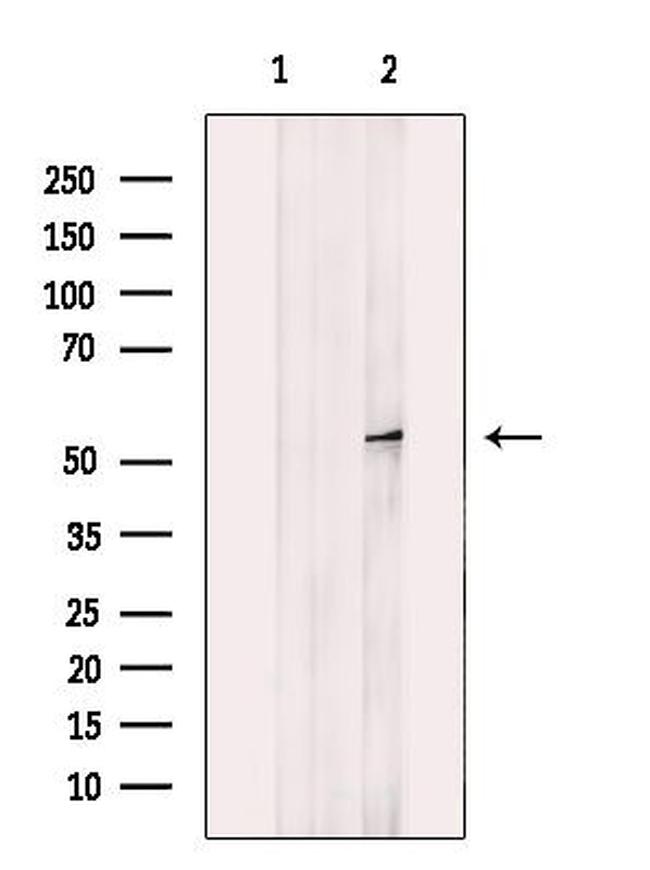 MCD Antibody in Western Blot (WB)