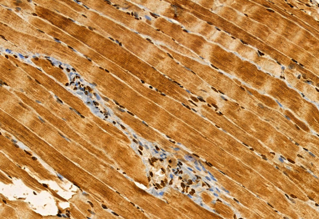 AP3B1 Antibody in Immunohistochemistry (Paraffin) (IHC (P))