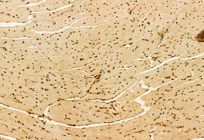 AP3B1 Antibody in Immunohistochemistry (Paraffin) (IHC (P))