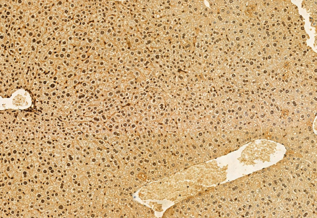 AP3B1 Antibody in Immunohistochemistry (Paraffin) (IHC (P))