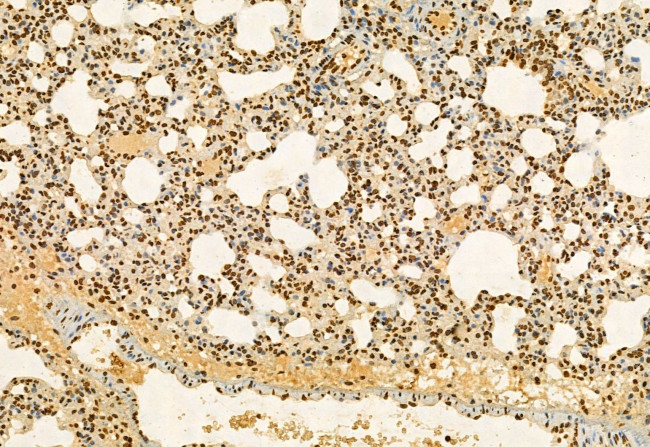 AP3B1 Antibody in Immunohistochemistry (Paraffin) (IHC (P))