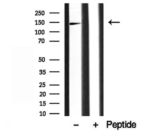 AP3B1 Antibody in Western Blot (WB)