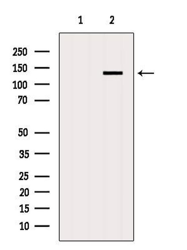 AP3B1 Antibody in Western Blot (WB)