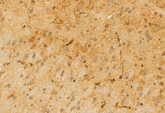 CISD2 Antibody in Immunohistochemistry (Paraffin) (IHC (P))