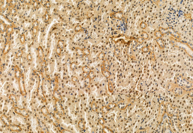 RDH10 Antibody in Immunohistochemistry (Paraffin) (IHC (P))