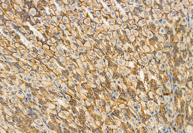 RDH10 Antibody in Immunohistochemistry (Paraffin) (IHC (P))