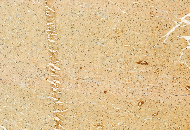 C9orf72 Antibody in Immunohistochemistry (Paraffin) (IHC (P))