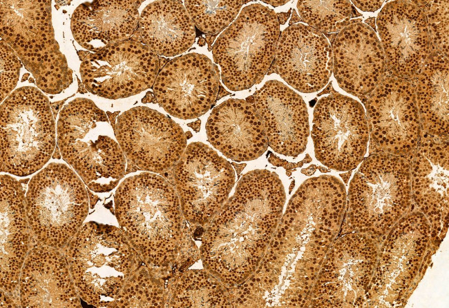 C9orf72 Antibody in Immunohistochemistry (Paraffin) (IHC (P))