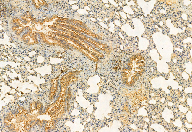 C9orf72 Antibody in Immunohistochemistry (Paraffin) (IHC (P))