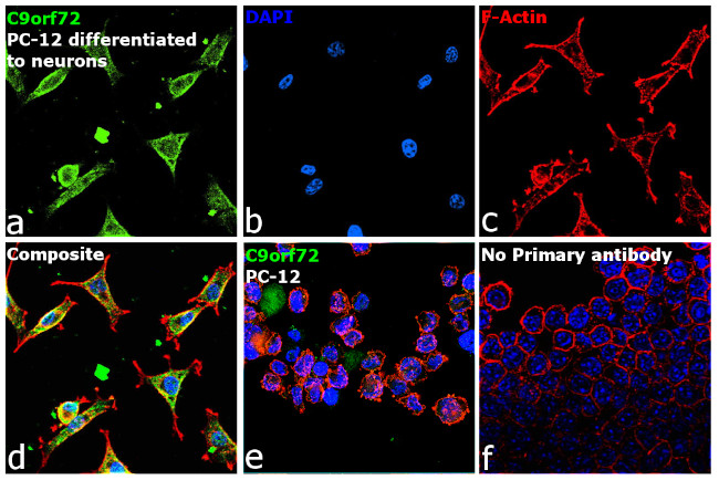 C9orf72 Antibody