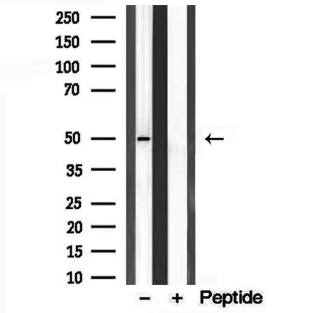 C9orf72 Antibody in Western Blot (WB)