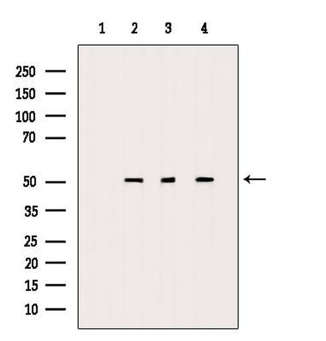 C9orf72 Antibody in Western Blot (WB)