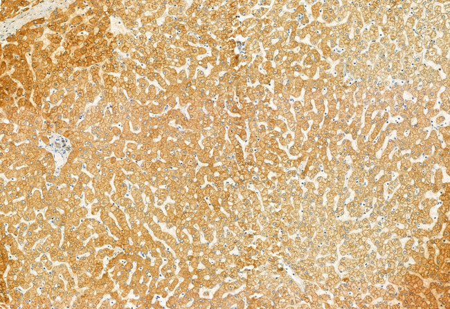 TCP-1 gamma Antibody in Immunohistochemistry (Paraffin) (IHC (P))