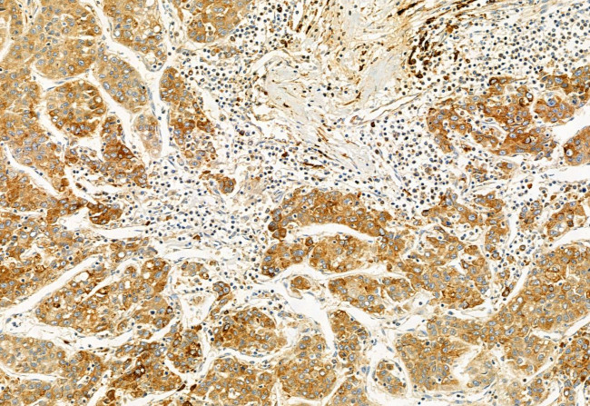 TCP-1 gamma Antibody in Immunohistochemistry (Paraffin) (IHC (P))