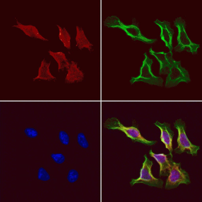 TCP-1 gamma Antibody in Immunocytochemistry (ICC/IF)