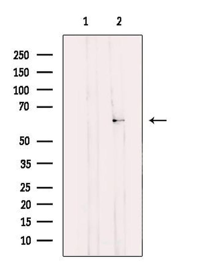 TCP-1 gamma Antibody in Western Blot (WB)