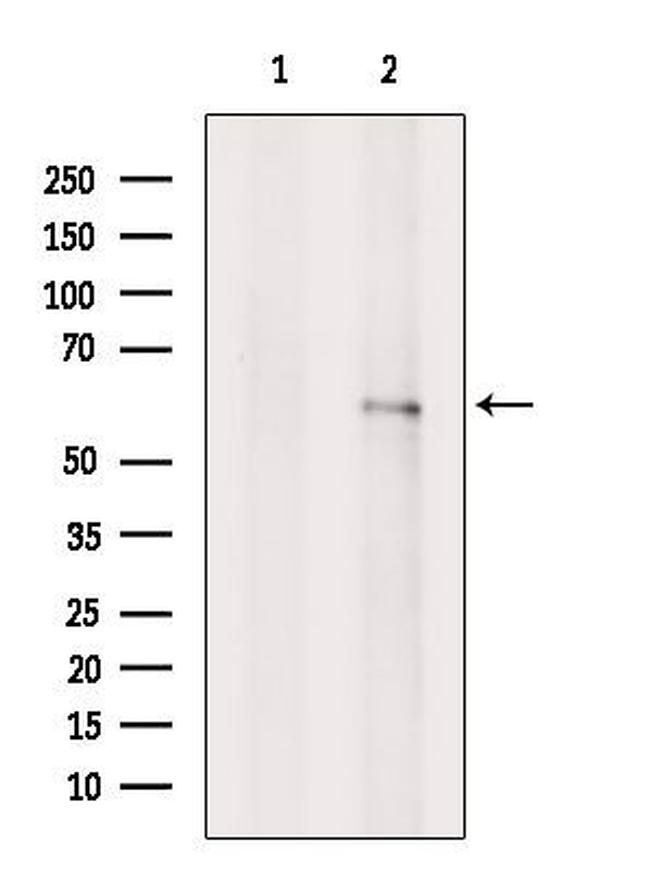 TCP-1 gamma Antibody in Western Blot (WB)