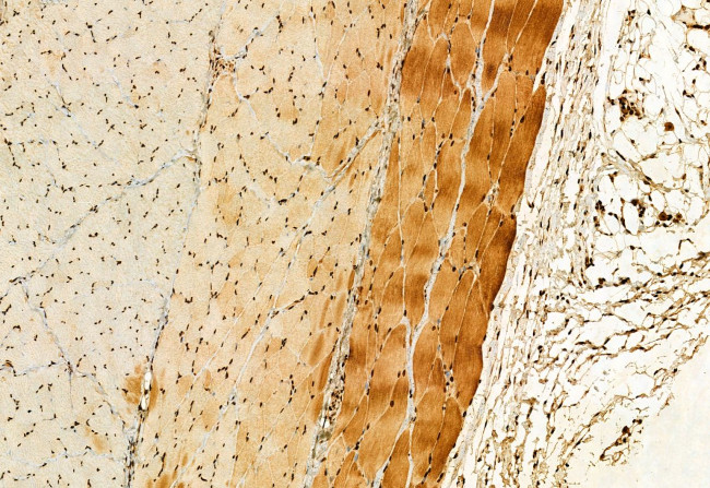 GluD1 Antibody in Immunohistochemistry (Paraffin) (IHC (P))