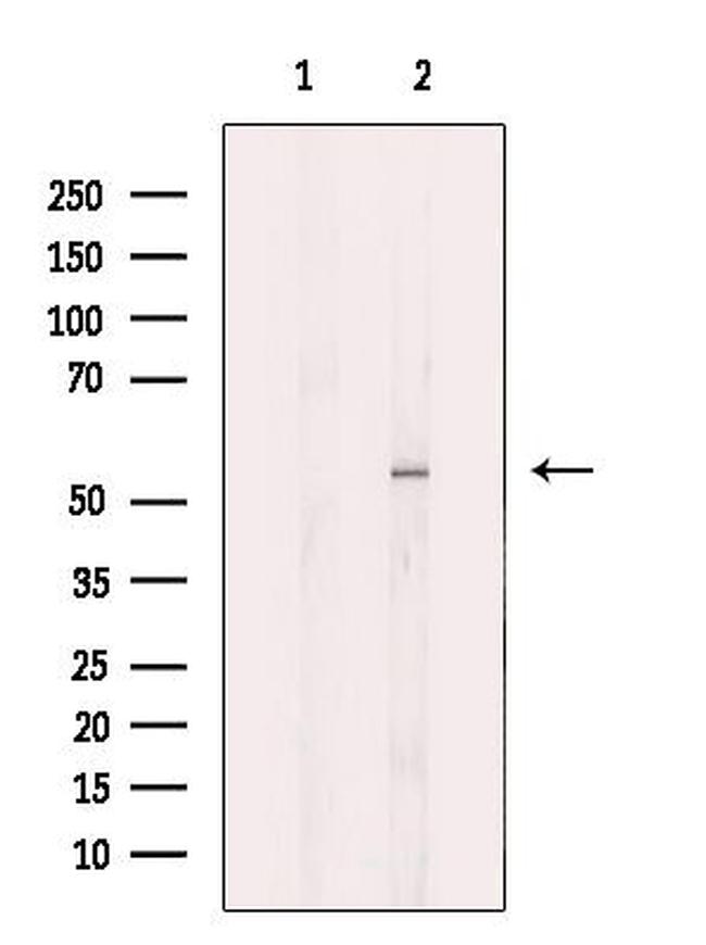 GluD1 Antibody in Western Blot (WB)