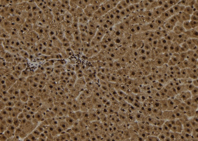 OGDH Antibody in Immunohistochemistry (Paraffin) (IHC (P))