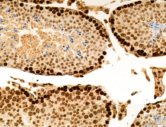 OGDH Antibody in Immunohistochemistry (Paraffin) (IHC (P))