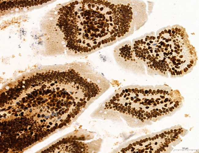 OGDH Antibody in Immunohistochemistry (Paraffin) (IHC (P))