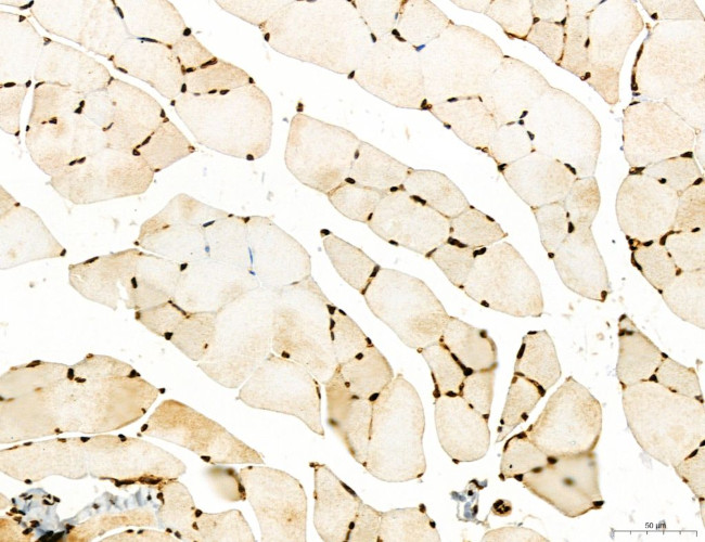 OGDH Antibody in Immunohistochemistry (Paraffin) (IHC (P))