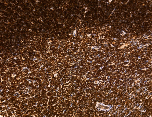 OGDH Antibody in Immunohistochemistry (Paraffin) (IHC (P))