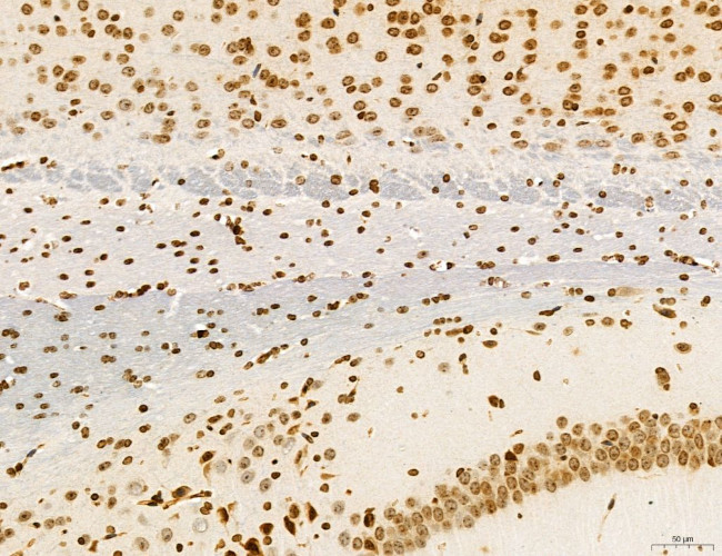 OGDH Antibody in Immunohistochemistry (Paraffin) (IHC (P))