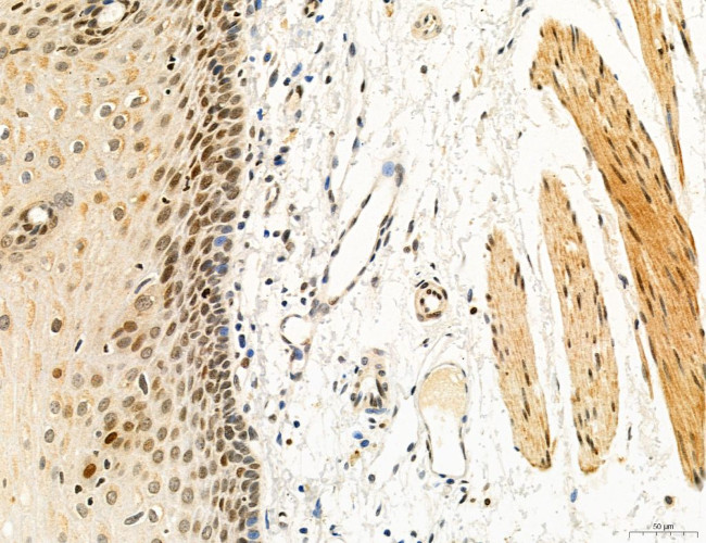 OGDH Antibody in Immunohistochemistry (Paraffin) (IHC (P))