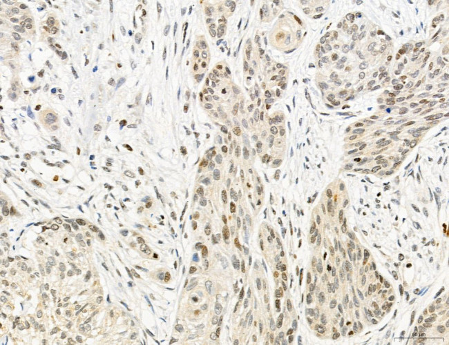 OGDH Antibody in Immunohistochemistry (Paraffin) (IHC (P))