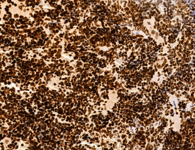 OGDH Antibody in Immunohistochemistry (Paraffin) (IHC (P))