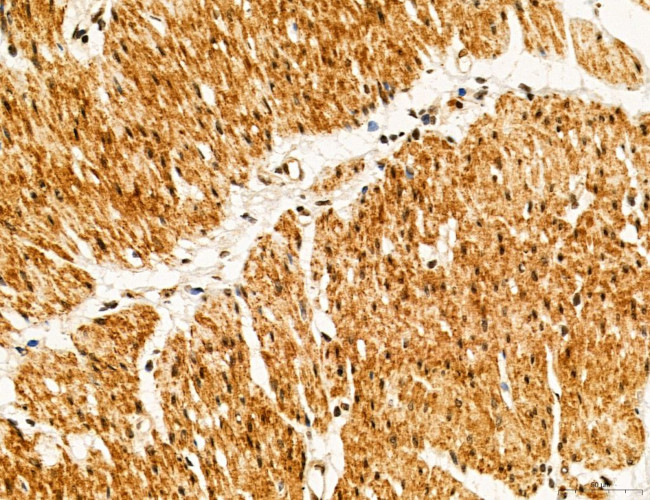 OGDH Antibody in Immunohistochemistry (Paraffin) (IHC (P))