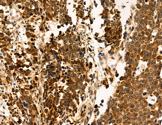 OGDH Antibody in Immunohistochemistry (Paraffin) (IHC (P))