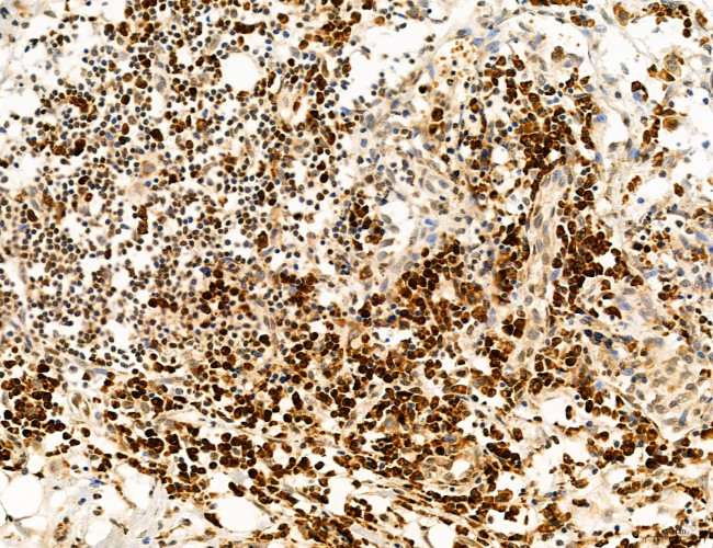 OGDH Antibody in Immunohistochemistry (Paraffin) (IHC (P))