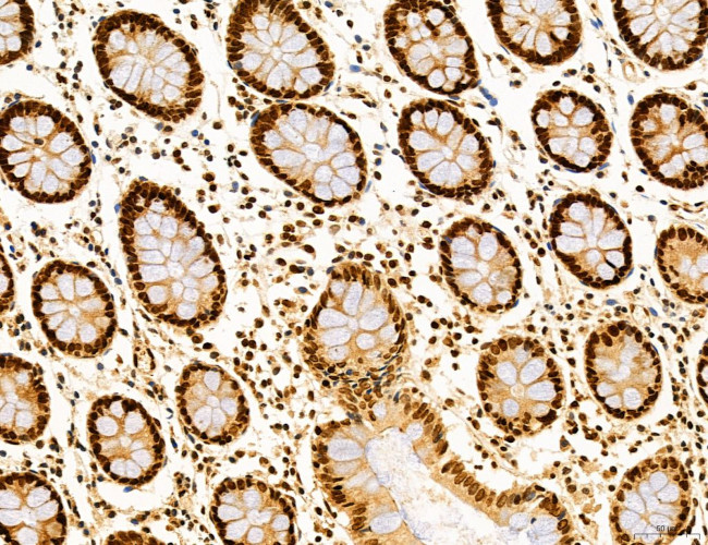 OGDH Antibody in Immunohistochemistry (Paraffin) (IHC (P))