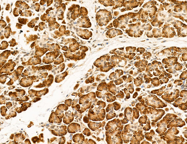 OGDH Antibody in Immunohistochemistry (Paraffin) (IHC (P))