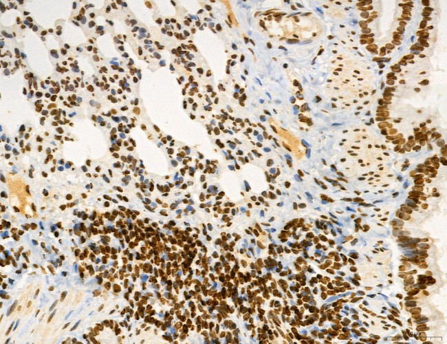 OGDH Antibody in Immunohistochemistry (Paraffin) (IHC (P))