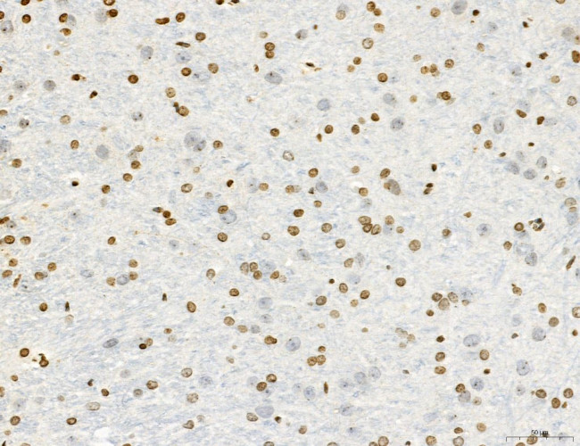 OGDH Antibody in Immunohistochemistry (Paraffin) (IHC (P))